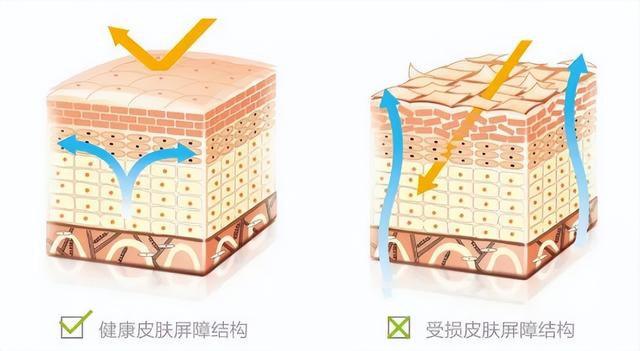 2 块钱一块的硫磺皂，是皮肤病“神器”还是毁肤“杀手”？