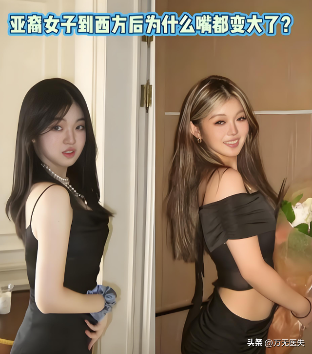 留学一年嘴都变大了，女学生面相变化图走红，牢A果然权威