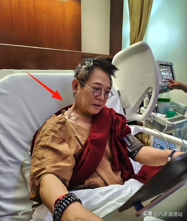 李连杰手术5天后，担心的事情发生了，5cm刀口也没换来大众同情