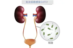 别把尿路感染当成“小毛病”！这9类人群容易感染，注意这些症状图片