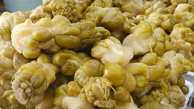 中国脑梗发病率世界第一！医生：罪魁祸首已揪出，这5物最好少吃