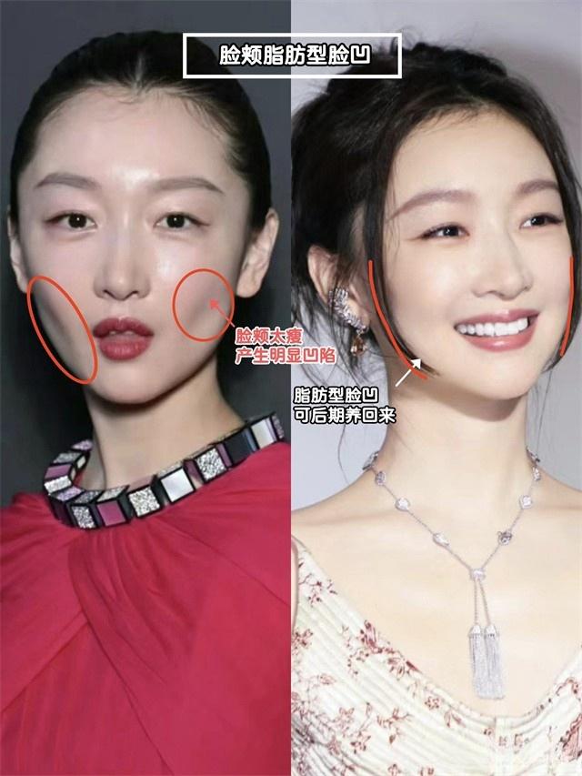 变老算什么，一脸“苦相”才可怕！显老显凶，难怪大家喜欢富贵相