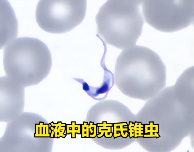 美国爆发新型疾病，传播速度快症状致命，我国暂未输入但须警惕！