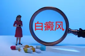 白癜风小知识概述图片