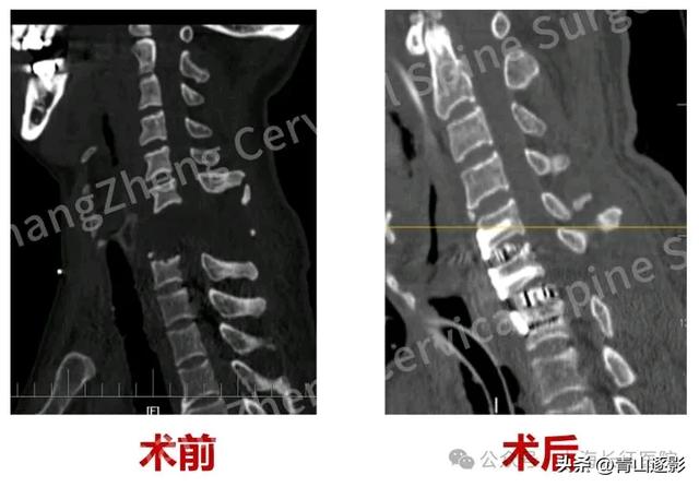 奇迹再次上演！上海长征医院改写医学史让全球医学界震惊