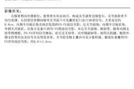 半月板撕裂三级，一定要做手术吗？图片