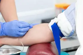 梅毒脚的典型表现！多数人或以为是得了脚气，可能会耽误病情图片