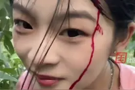 女子上树摘板栗遭“反击”，刚出手摇树就被板栗击中头部，“最后还是摘了，这点小事不算什么”图片