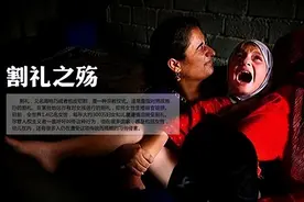 割礼是什么？世界上有哪些民族要施行割礼呢？图片