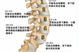 每节腰椎间盘突出对应的症状图片