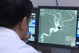 一时兴起挑战自我 女子一口气跳绳2000个引发脑出血图片