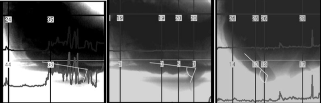 上厕所，坐着好还是蹲着好？最佳姿势竟然是……