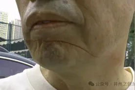 男子骑行险被“割喉”！ 当心藏在空中的伤人利器图片