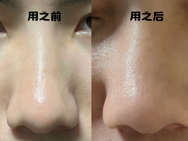 2025油皮必看！十大油皮洗面奶排行榜，好用不踩雷