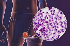 体检查出 CA 升高别慌！肿瘤标志物的正确解读图片