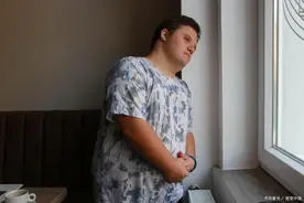 被锁住的面孔：唐氏儿为啥长得都一样？他们为啥遗传不到父母样貌图片