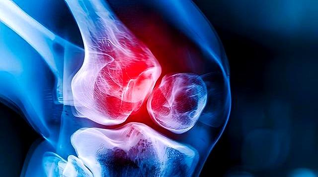 北京协和：高血脂可以做的运动排名，不知道的高血脂患者太亏了！