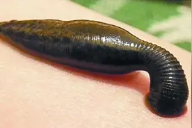 蚂蟥可在鼻腔眼睛，甚至隐私部位寄生！若进入肚子，会长期存活吗图片