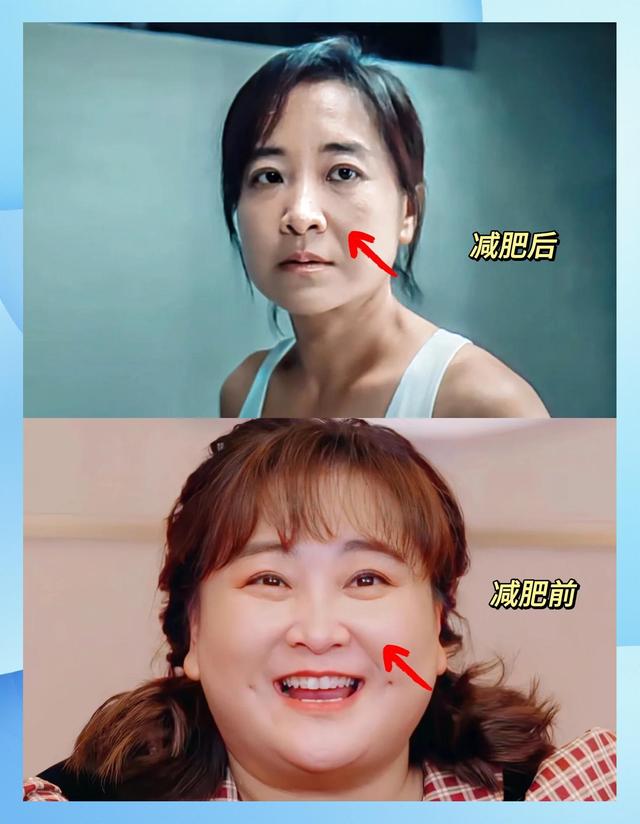 瘦到脱相？43岁的贾玲罕见露面，脸跨不平、又瘦又"颓"，令人唏嘘