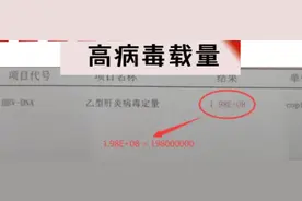 乙肝病毒定量多高算高？一次性讲清楚！图片