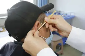 小小耳穴作用大！东营市中医院邀您来体验耳穴贴压技术图片
