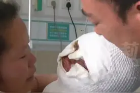 热油烫伤两岁男孩，已经毁容！父母自责不已，别再指责孩子妈妈了图片