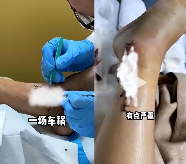 挣再多钱有啥用？两年4次手术，11部作品被下架，今生活无法自理