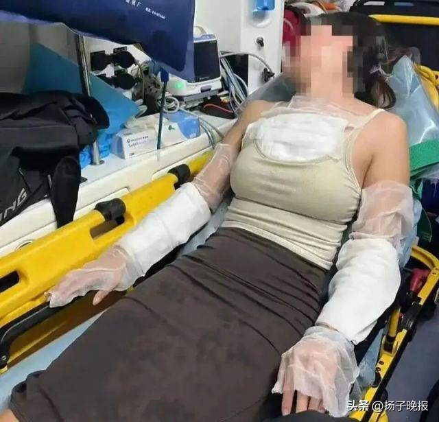 女子大连旅游被日料店服务员泼开水烫伤，患中度抑郁！当事人：曾接到电话警告不要随便发视频，已起诉店家