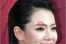 千金难买到五颗痣，看看你有吗？图片