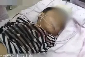 16年7岁娃吃3根冰棍后口吐鲜血，下体也流血不止，不得已开腹检查图片