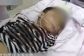 16年7岁娃吃3根冰棍后口吐鲜血，下体也流血不止，不得已开腹检查图片