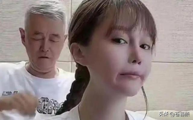 有钱有什么用？68岁赵本山近况曝光，三人打伞伺候，女儿是心头病