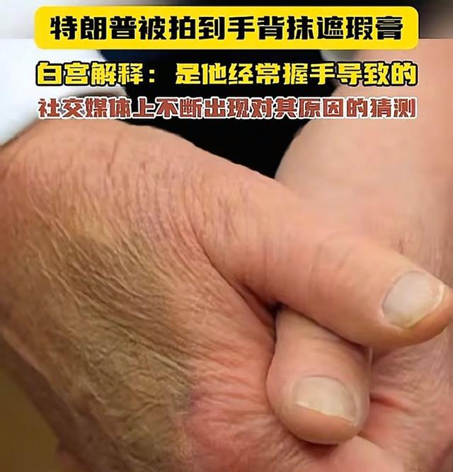 特朗普的身体到底出了什么问题