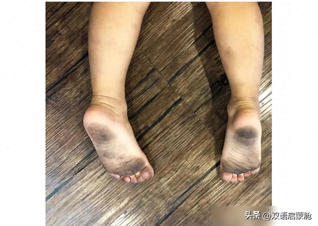 说真的，孩子爱光脚，真正的坏处只有一个！