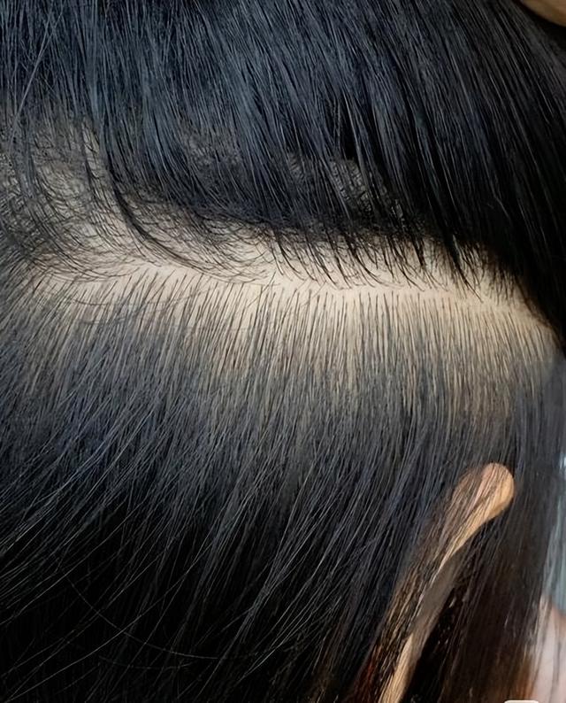 上海一女子用“硫磺皂”洗头，坚持半年后	，出现了这4个变化