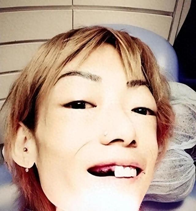 豪门玩物	，几年被折磨成牙齿全脱落，不足80斤，似骷髅，惨不忍睹