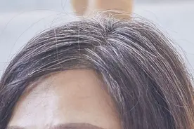 洗头加几片土豆皮，竟是天然的“染发剂”，以前扔掉实在太可惜了图片