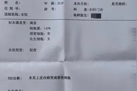 标题：《妇科检查之痛：鸭嘴钳与女性尊严》图片