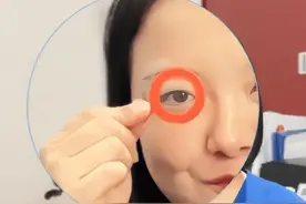 近视影响颜值，到底有没有医学根据？图片