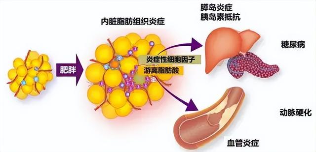 研究建议：把主食换成它，全身炎症都会下降！