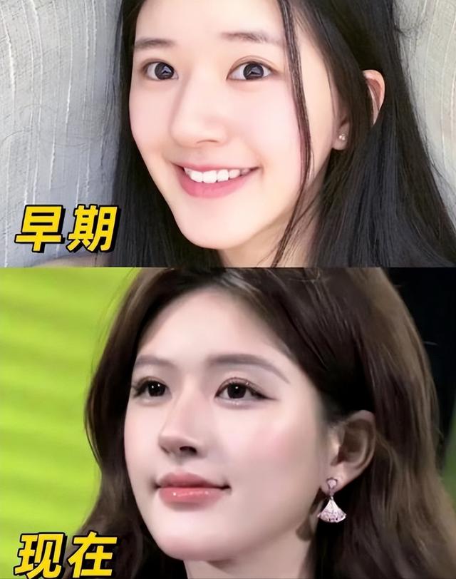 比整容还离谱！39岁江疏影现身活动，脸僵似硅胶，造型丑到认不出