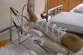 骨折往事：术前遭遇的种种非人折磨，骨折疼痛与噩梦般的牵引经历图片