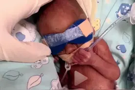 签字放弃早产儿，或许真的是无奈之举，天价费用图片