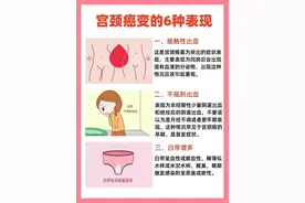 HPV小心！宫颈癌变的6大表现，如何预防？图片