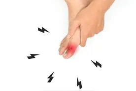 怎么判断大脚趾疼痛是不是痛风？图片