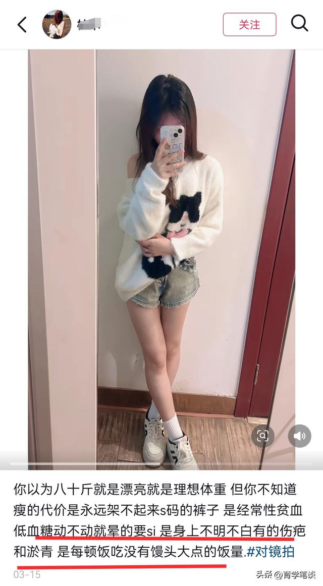 江西女幼师刘慧去世，仅21岁，娃娃脸很漂亮，身上莫名淤青后确诊