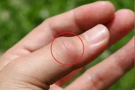 56岁男子，坚持每天喝车前草水治痛风，3个月后，健康情况如何？图片