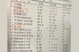 血常规这3项出现异常，小心肿瘤找上你！图片