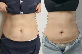 产后腰腹赘肉甩不掉！43岁宝妈亲测：腰腹环吸14天，重获少女腰！图片