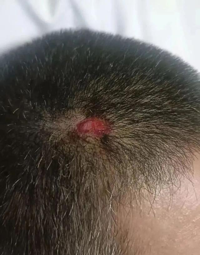 3米高广告牌突然倒塌，佛山男子住院32天索赔16万被拒	，涉事商家质疑：伤情不需要住院这么长时间